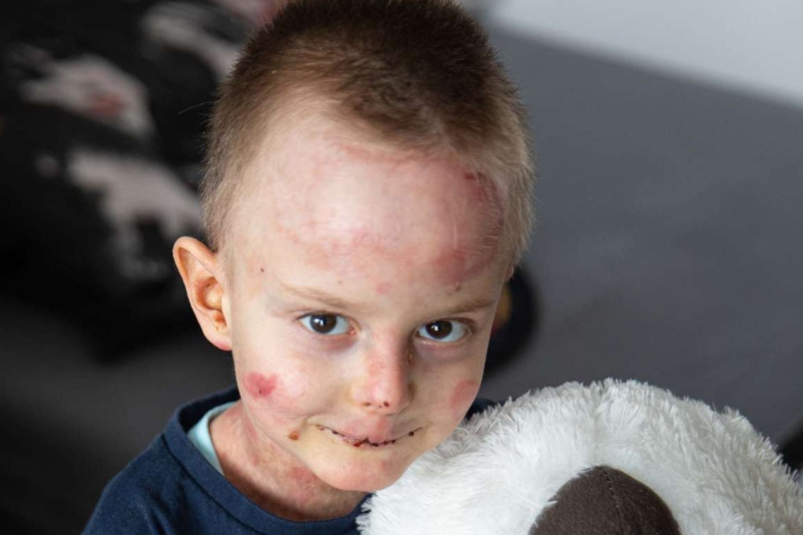 Otroci z redkimi boleznimi še naprej brez dostopa do najnovejših zdravil